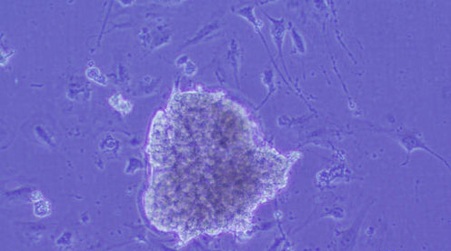 Cardiac stem cells