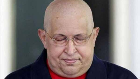 Hugo Chavez chemotherapy